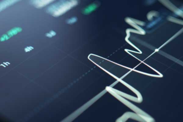 张津镭:黄金围绕5000美元震荡,非农数据或成多空“分水岭”